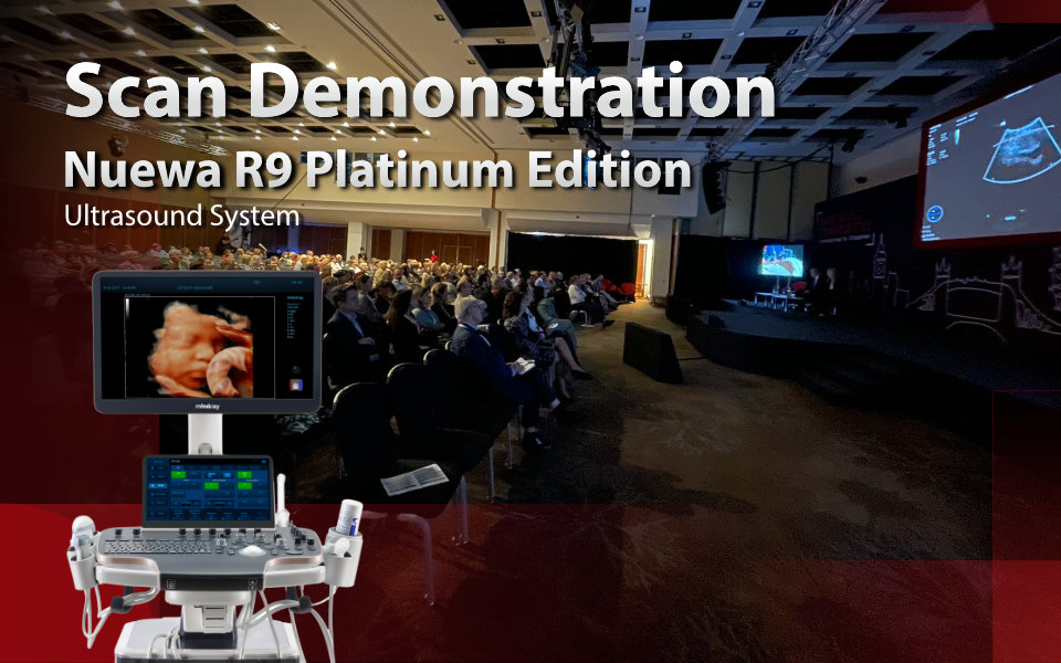 Nuewa R9 Platinum Edition Ultrasound System