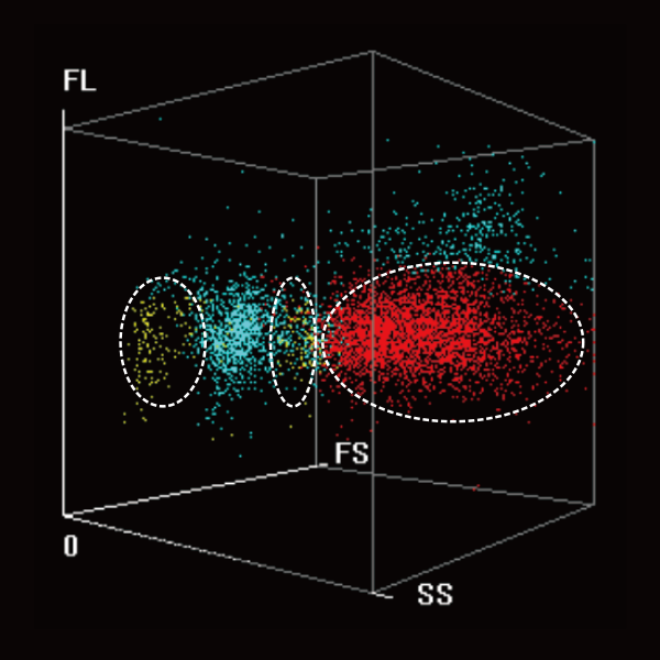 BC-7600 Series Auto Hematology Analyzers - Typical samples of acute promyelocytic leukemia (APL)