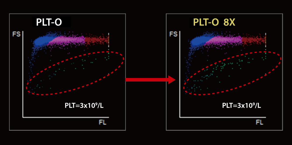 BC-7600 Series Auto Hematology Analyzers - PLT-O with Multiple Counting for Low-count Platelet