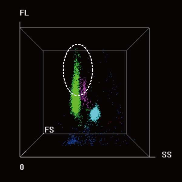 BC-7600 Series Auto Hematology Analyzers - 3D Scattergram of typical infectious mononucleosis