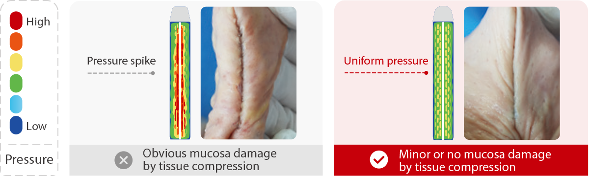 Second stage: Firing compression - Obvious vs. Minor Mucosa Damage