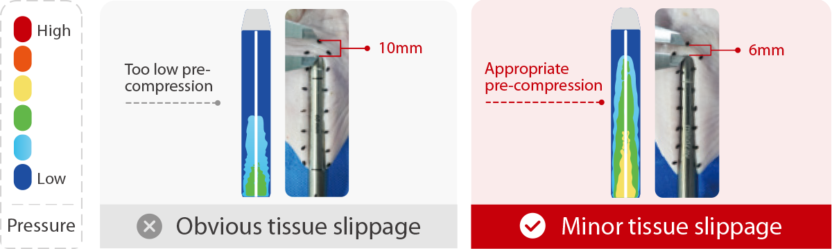 First stage: Pre-compression - Obvious vs. Minor Tissue Slippage