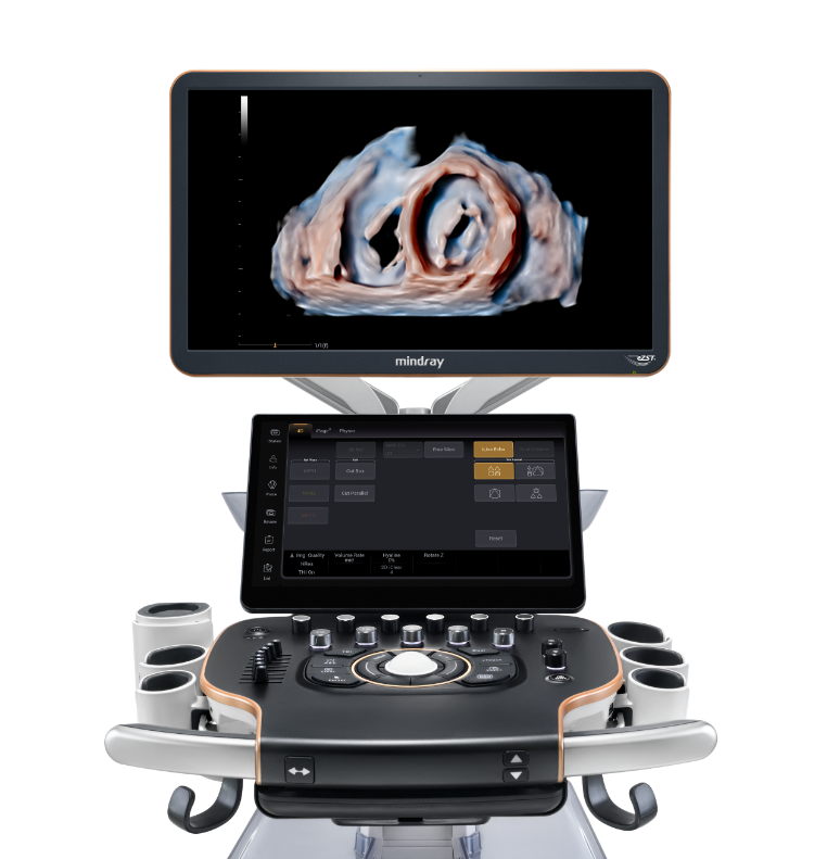 Recho R9 Product Image - Front View