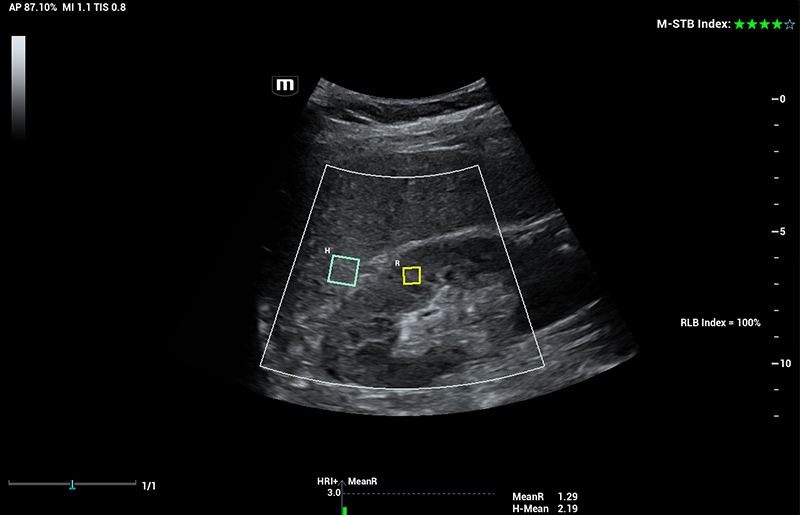 LETOU国际米兰·(中国区)官方网站
