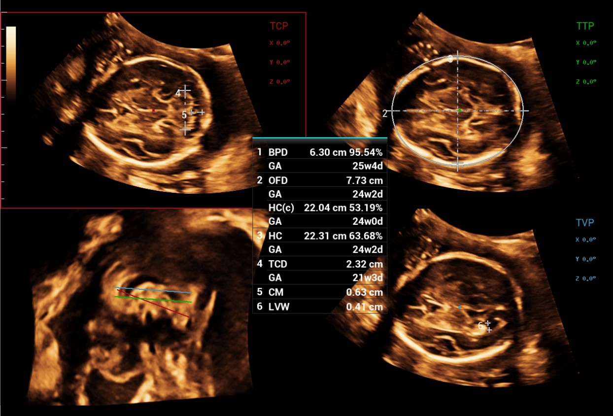 LETOU国际米兰·(中国区)官方网站