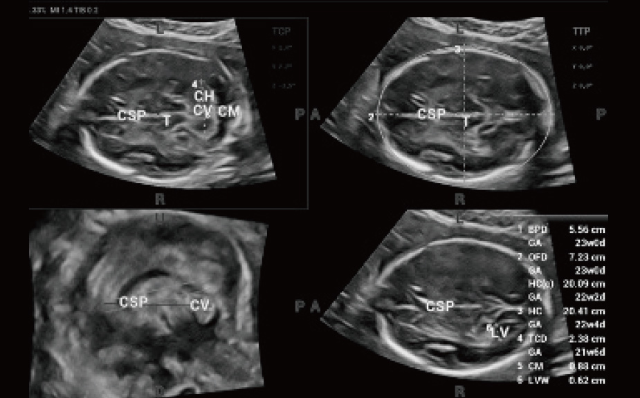 LETOU国际米兰·(中国区)官方网站