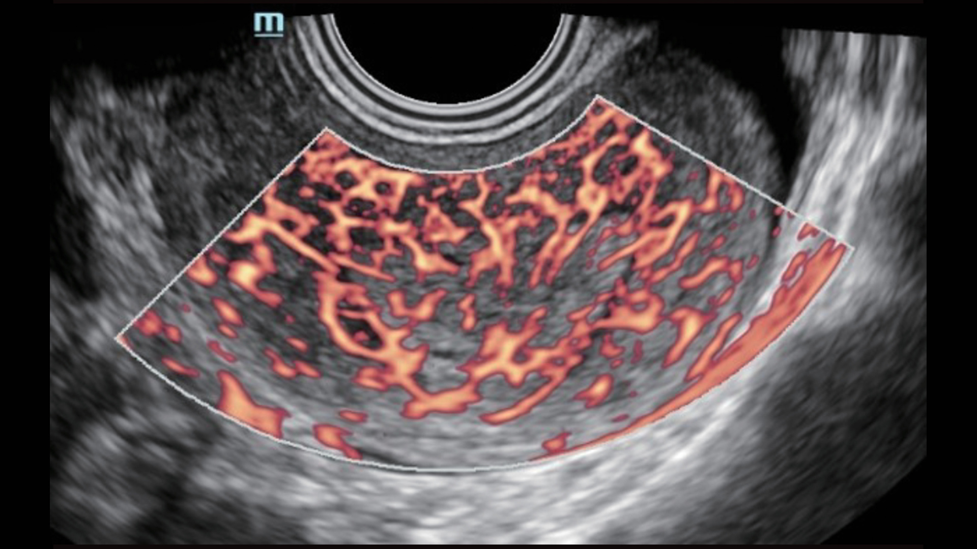 LETOU国际米兰·(中国区)官方网站