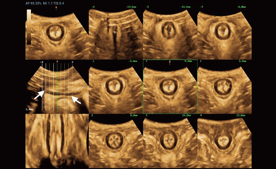LETOU国际米兰·(中国区)官方网站