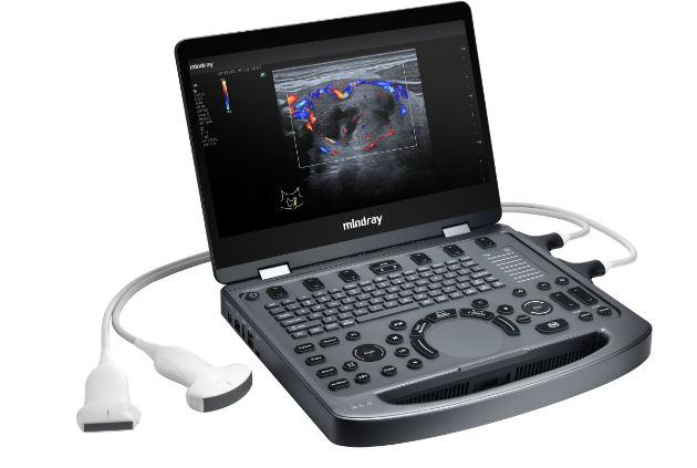 MX5 product left view with transducers