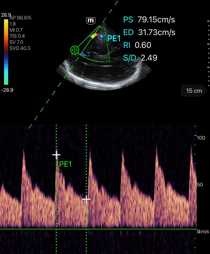 Modalità doppler pulsato