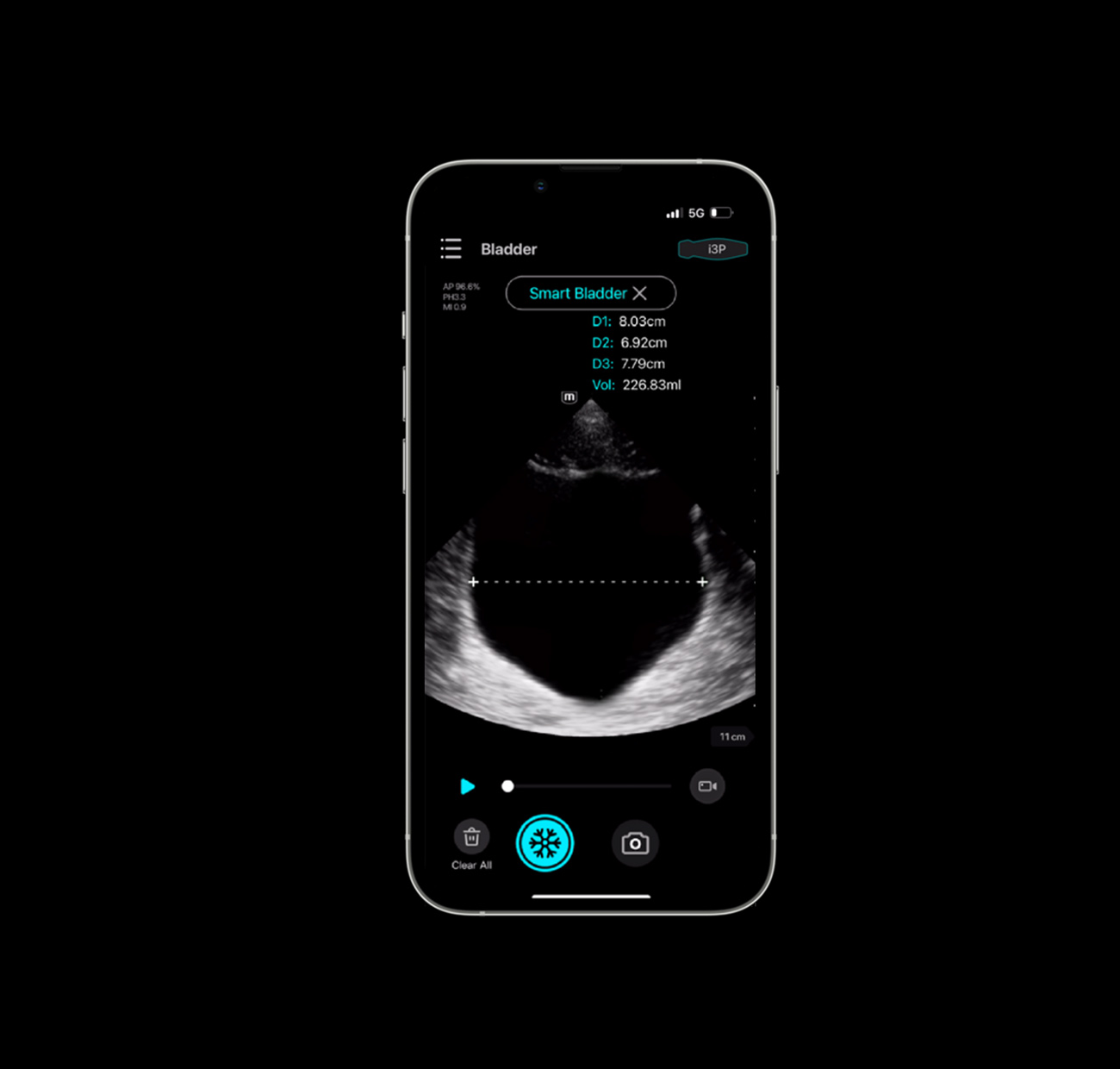 Smart Bladder, per guadagnare tempo, in modo più semplice