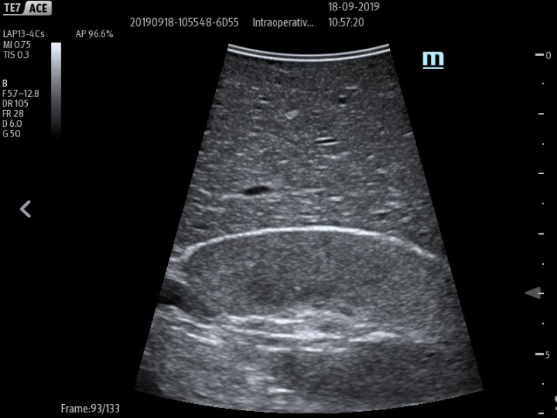 LAP13-4Cs_Kidney_1-800x600