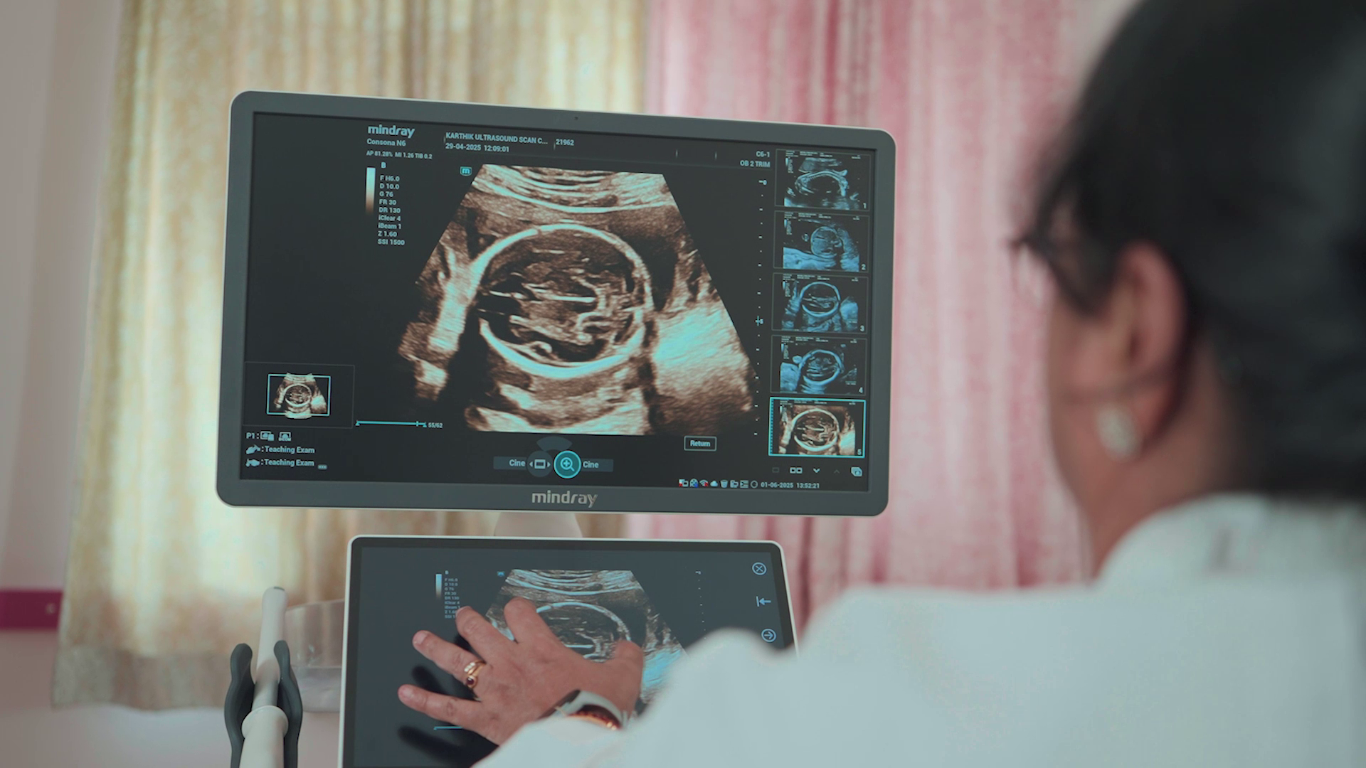 Doctor performing ultrasound