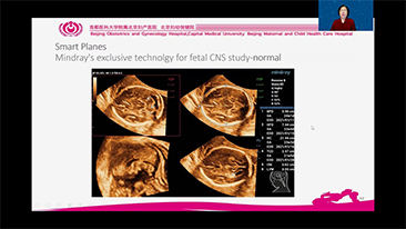LETOU国际米兰·(中国区)官方网站