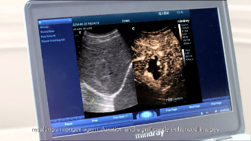 LETOU国际米兰·(中国区)官方网站