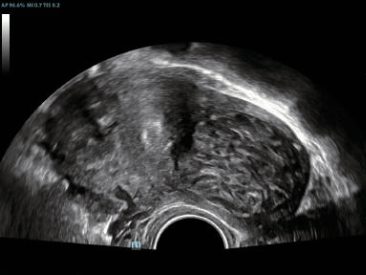 dc-80-exp-ru-fig7-14