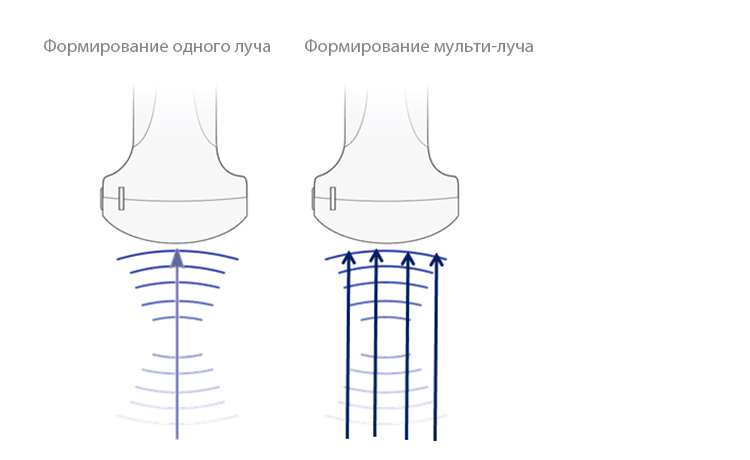 aac1316f-d922-4176-b645-b589469bbbf7