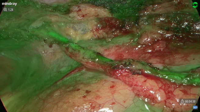 LETOU国际米兰·(中国区)官方网站