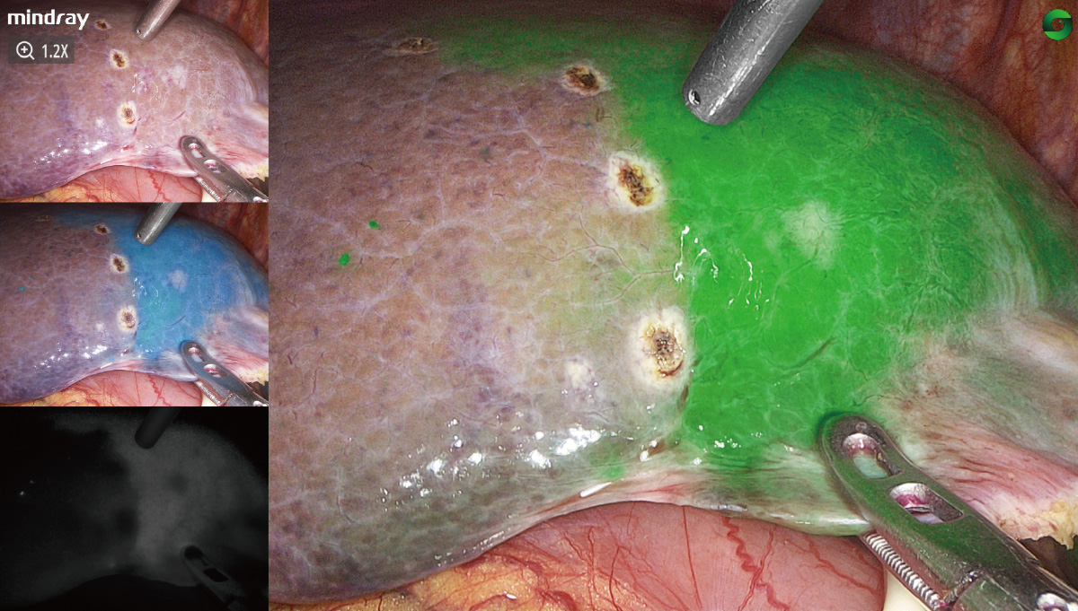 LETOU国际米兰·(中国区)官方网站