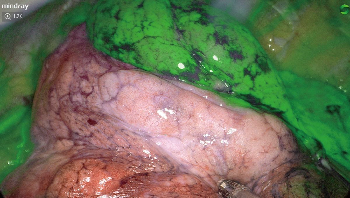 LETOU国际米兰·(中国区)官方网站