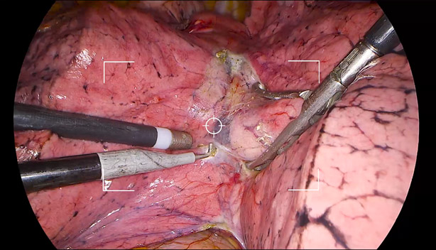 LETOU国际米兰·(中国区)官方网站