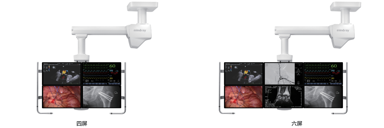 HyPort P系列医用吊塔系统-提供多屏幕组合装置计划