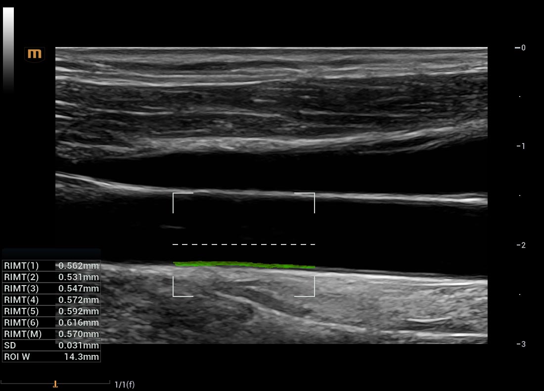 LETOU国际米兰·(中国区)官方网站