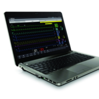 BeneVision CMS Viewer