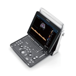 Z60 Hand-Carried Ultrasound System:
